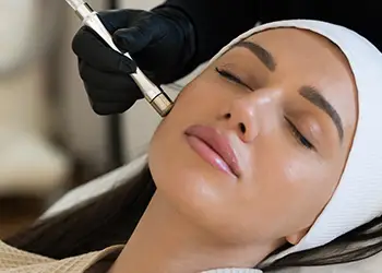 Microneedling