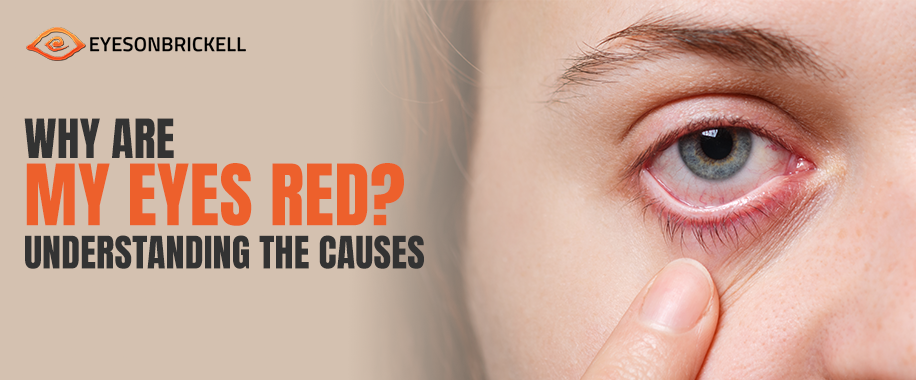 red eye treatment
