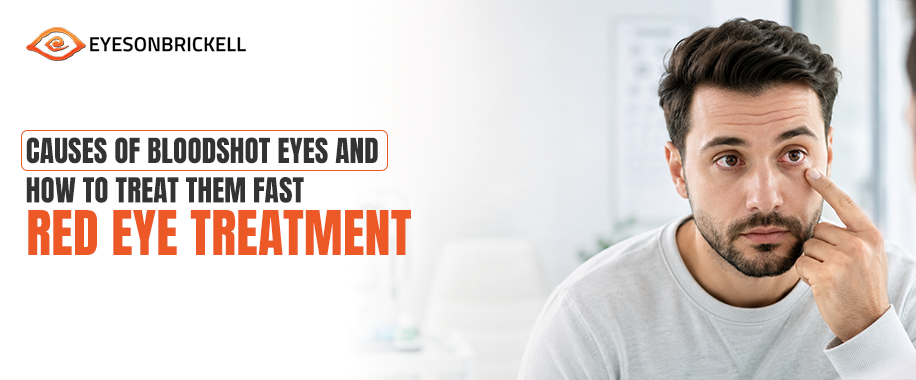 red eye treatment